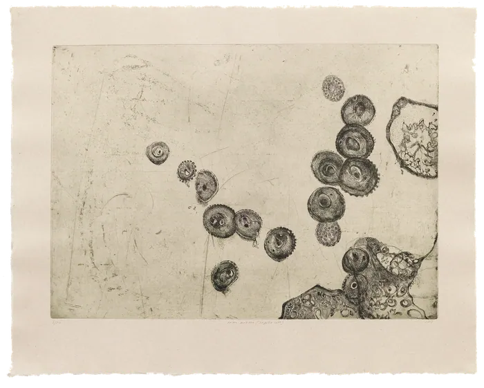 Prima Materia (Infected Cells)